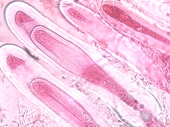 Pertusaria heterochroa