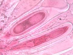 Pertusaria heterochroa