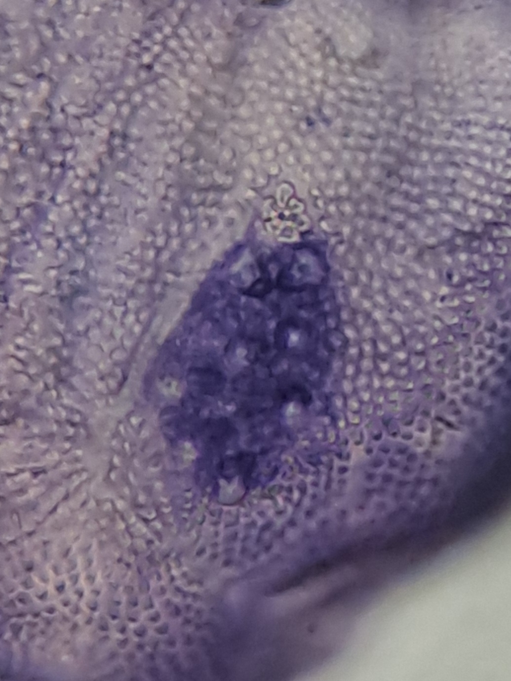 Brachystomella parvula (Schäffer, 1896)