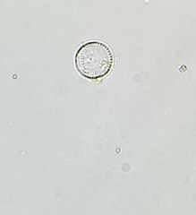 Thalassiosirales