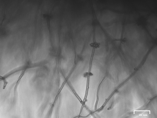 Cordyceps bassiana image