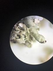 Cladonia mateocyatha