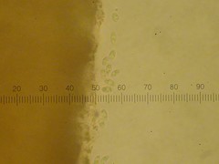 Trapeliopsis glaucopholis