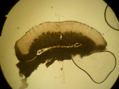 Trapeliopsis glaucopholis