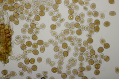 Puccinia lagenophorae