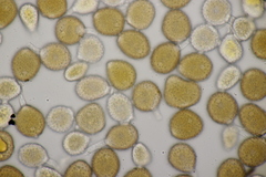 Puccinia lagenophorae