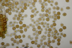 Puccinia lagenophorae