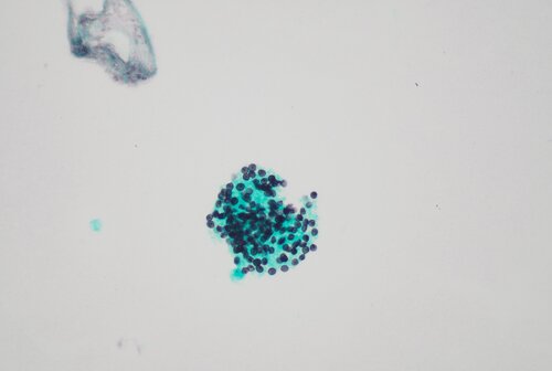 Pneumocystis
