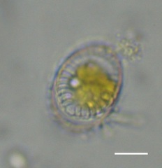 Surirella