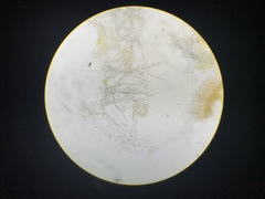 Lachnellula calyciformis