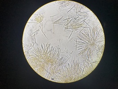 Lachnellula calyciformis