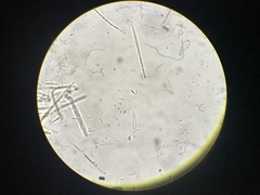 Lachnellula calyciformis