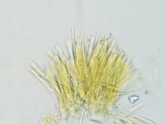 Lachnellula cervina