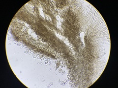 Ciboria batschiana