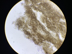 Ciboria batschiana