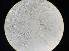 Ciboria batschiana