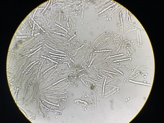 Ciboria batschiana
