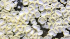 Cyphellaceae
