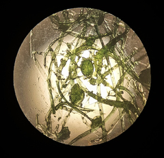 Rhizopus stolonifer