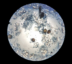 Synchytrium endobioticum