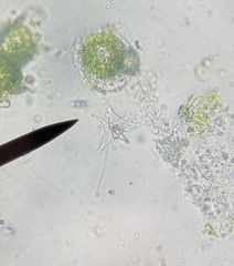 Staurastrum anatinum