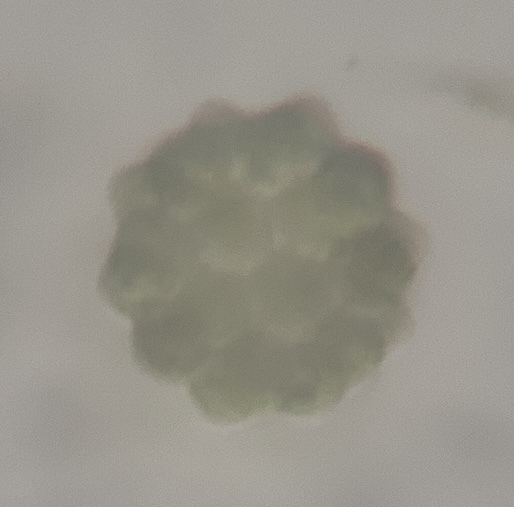 Coelastrum from Palm Bay, FL, US on March 15, 2026 at 12:32 PM by James ...