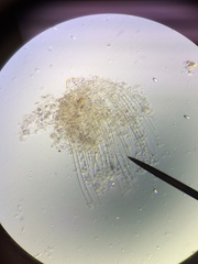 Actinosphaerium