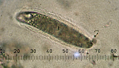 Pertusaria thiospoda