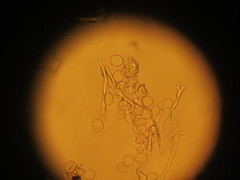 Plasmopara praetermissa