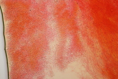 Phlebia rufa