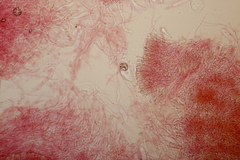 Phlebia rufa