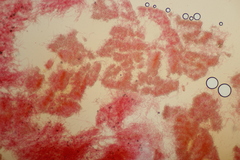 Phlebia rufa