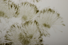 Sclerencoelia fraxinicola