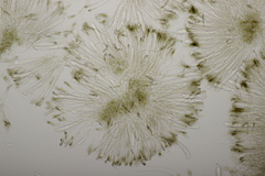 Sclerencoelia fraxinicola