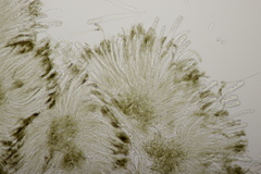 Sclerencoelia fraxinicola