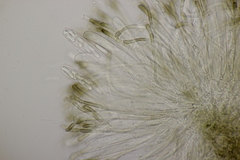 Sclerencoelia fraxinicola