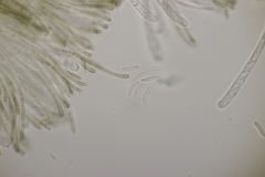 Sclerencoelia fraxinicola