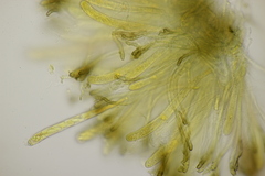 Sclerencoelia fraxinicola