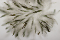 Chaetosphaerella phaeostroma