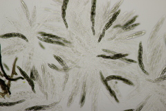 Chaetosphaerella phaeostroma
