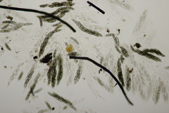 Chaetosphaerella phaeostroma