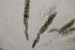 Chaetosphaerella phaeostroma