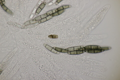 Chaetosphaerella phaeostroma