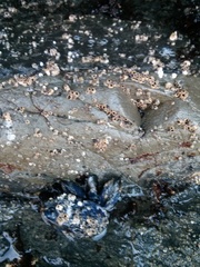 Thoracicalcarea