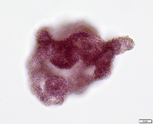 Lamprocystis observed 2026-03-19