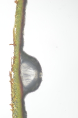 Pertusaria leioplaca