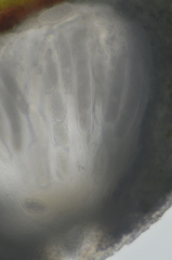 Pertusaria leioplaca