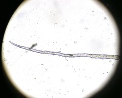 Grimmia pulvinata