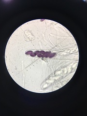 Ascobolus sacchariferus