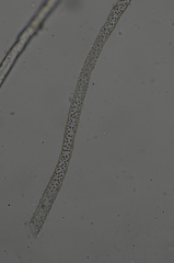 Mannia gracilis